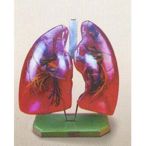 폐와 기관지 모형