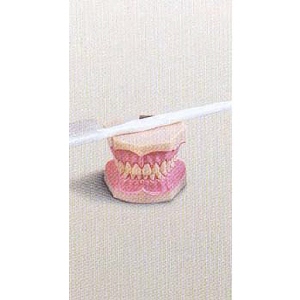 치아모형